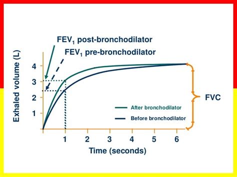 spirometry before and after bronchodilator